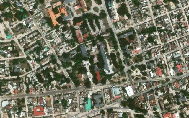 Las siamesas cubanas Maylín y Mayelín separadas
